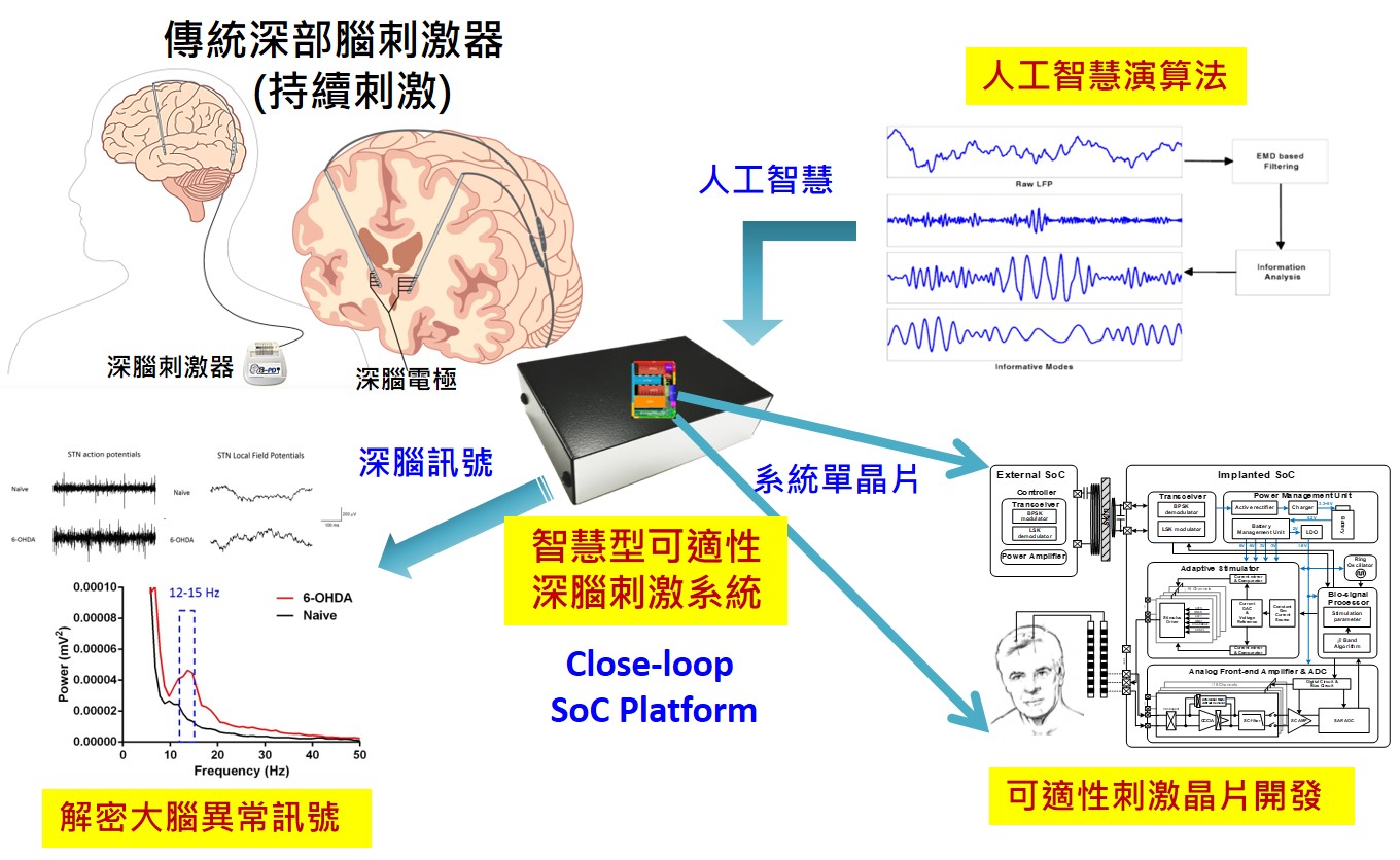 圖一、智慧型可適性閉迴路深腦刺激系統