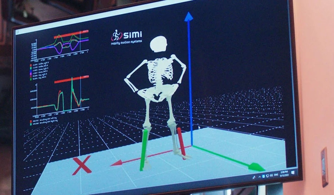 Skeletal image on screen